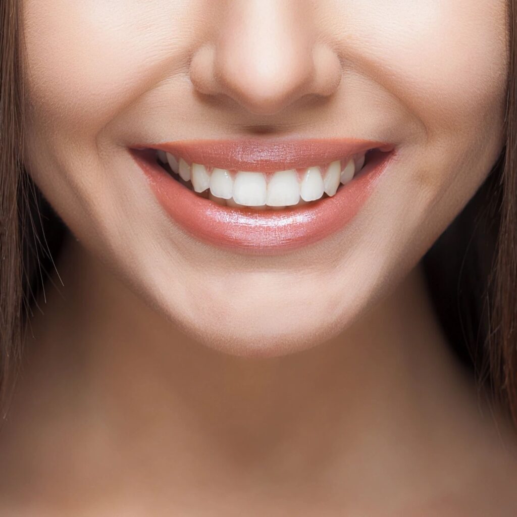 68017-89867 Teeth Whitening